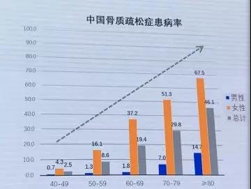 中國(guó)人骨密度從多少歲開始減少